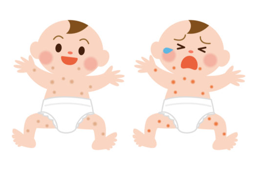 赤ちゃんのお肌がぶつぶつに 乳児湿疹ってどんな症状 Mimi Stage